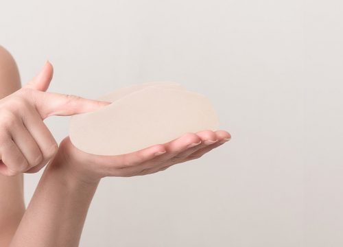 Photo of a woman holding a breast implant